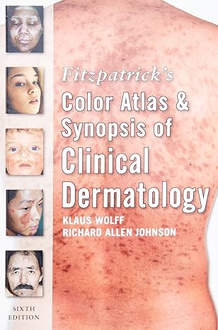 Fitzpatrick's Color Atlas and Synopsis of Clinical Dermatology, Seventh Edition (Color Atlas & Synopsis of Clinical Dermatology (Fitzpatrick)) 7th Edition